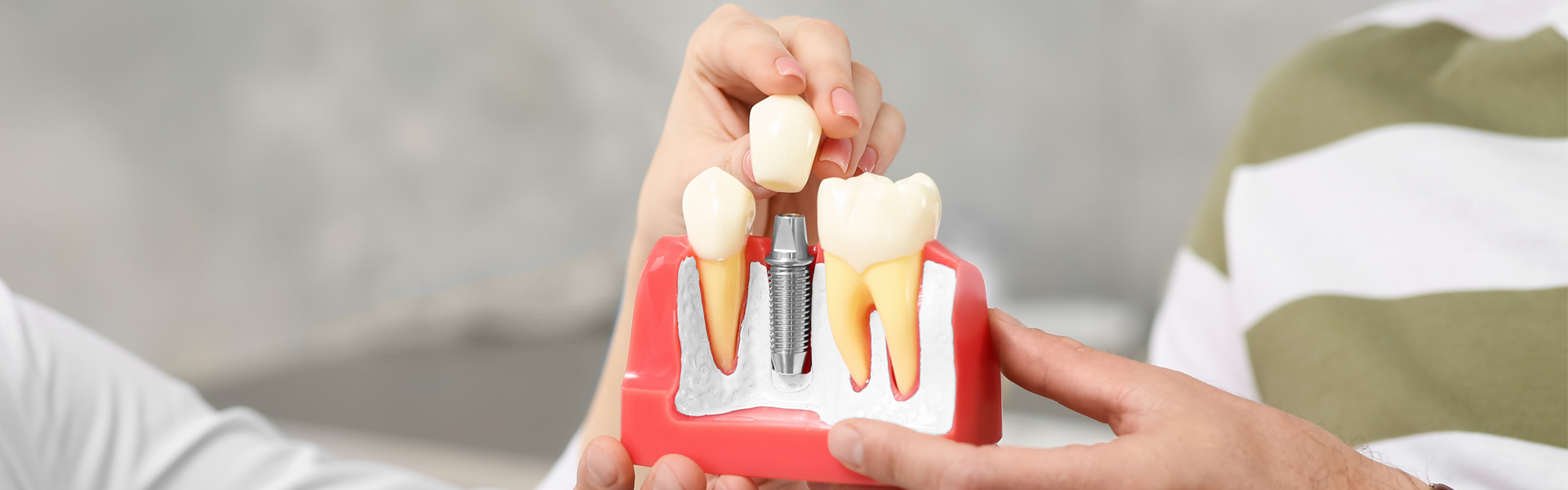 Dental Implants In Sharon, MA