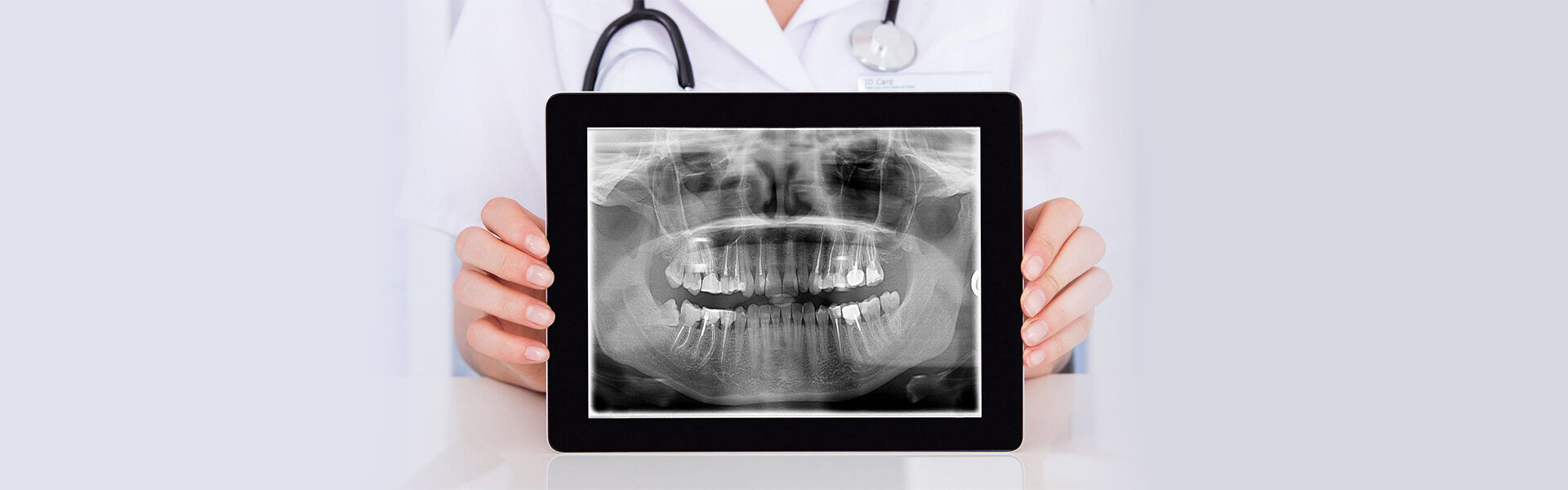 Digital Dental X-Rays in Sharon, MA