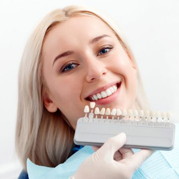 Dental Veneers: Types and Benefits